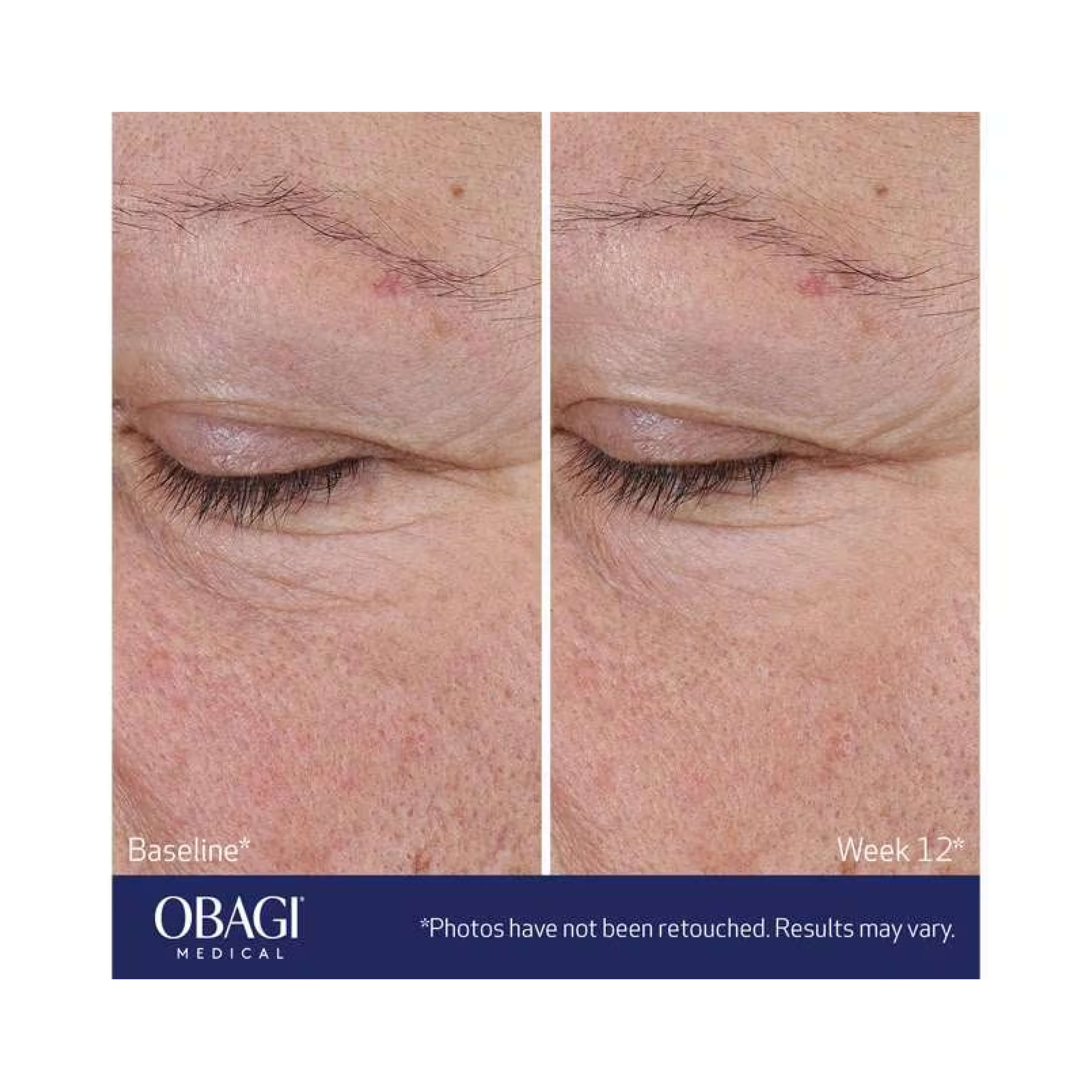 Obagi ELASTIderm® Advanced Filler Concentrate