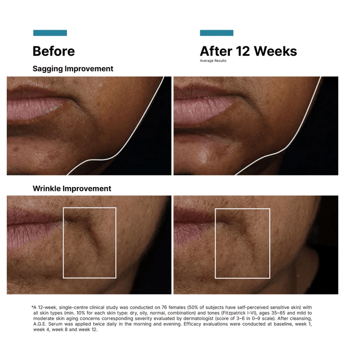 MAUD_SkinceuticalsA.G.E.InterrupterUltraSerumbeforeandafter - PreLoved & Luxe