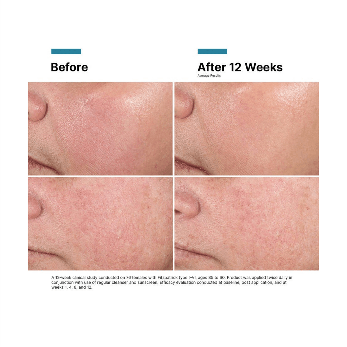 SkinCeuticalsAdvancedRGN-6beforeandafter_e2eb836f-1f80-442f-bd45-56882b8186d3 - PreLoved & Luxe