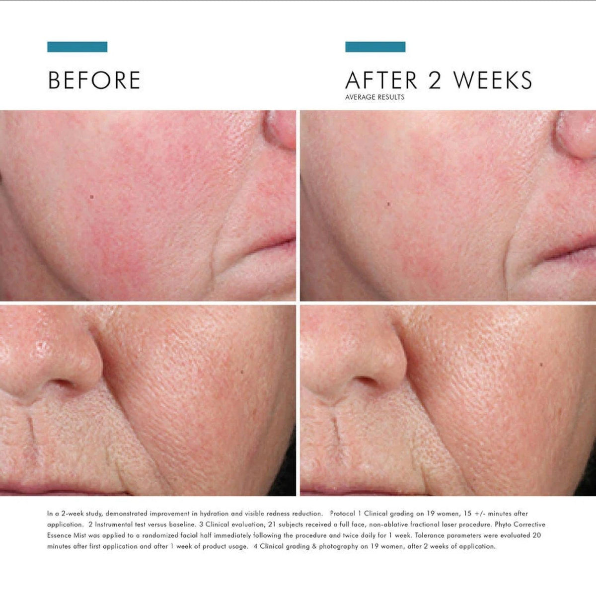 SkinCeuticals_Phyto_Corrective_Essence_Mist_before_and_after_64f52e02-e6d2-4f8f-98ec-9f146a6f06ef - PreLoved & Luxe
