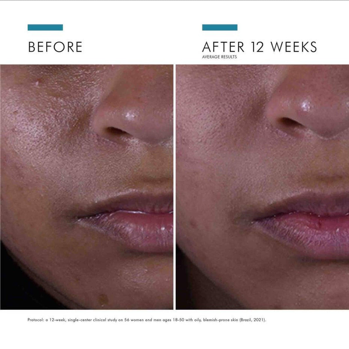 SkinCeuticals_Silymarin_CF_before_and_after - PreLoved & Luxe