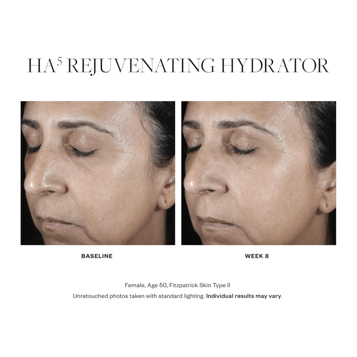 SkinMedicaHA5RejuvenatingHydrator-beforeandafter - PreLoved & Luxe