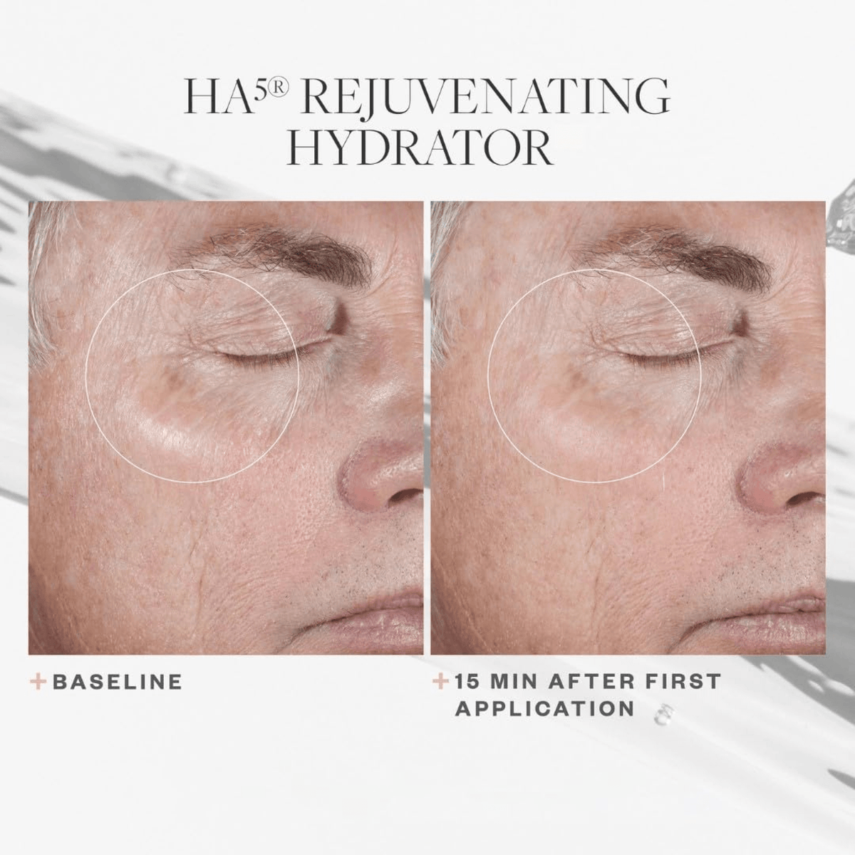 SkinMedicaHA5RejuvenatingHydratorbeforeandafter - PreLoved & Luxe
