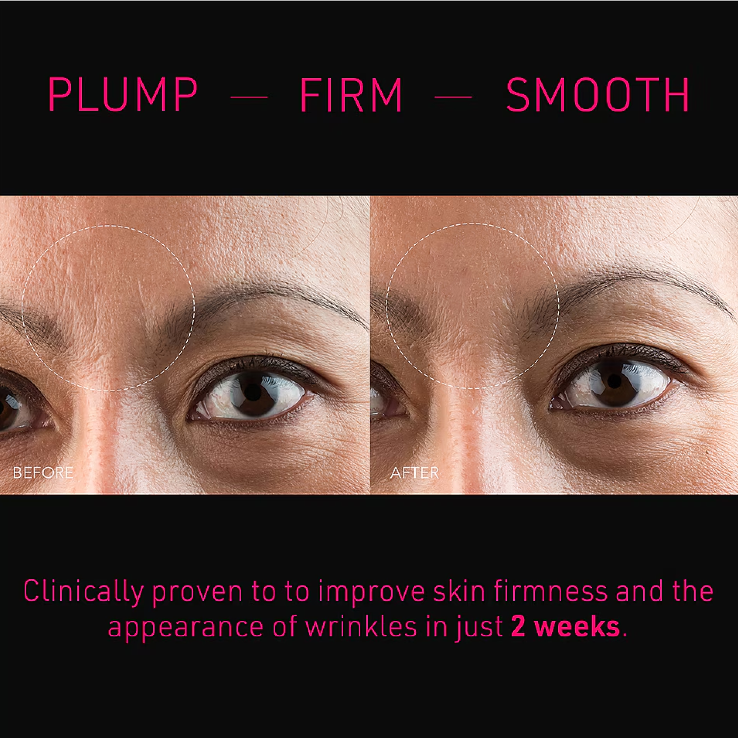 FOREO FAQ Microneedling Patches For Forehead (3x)