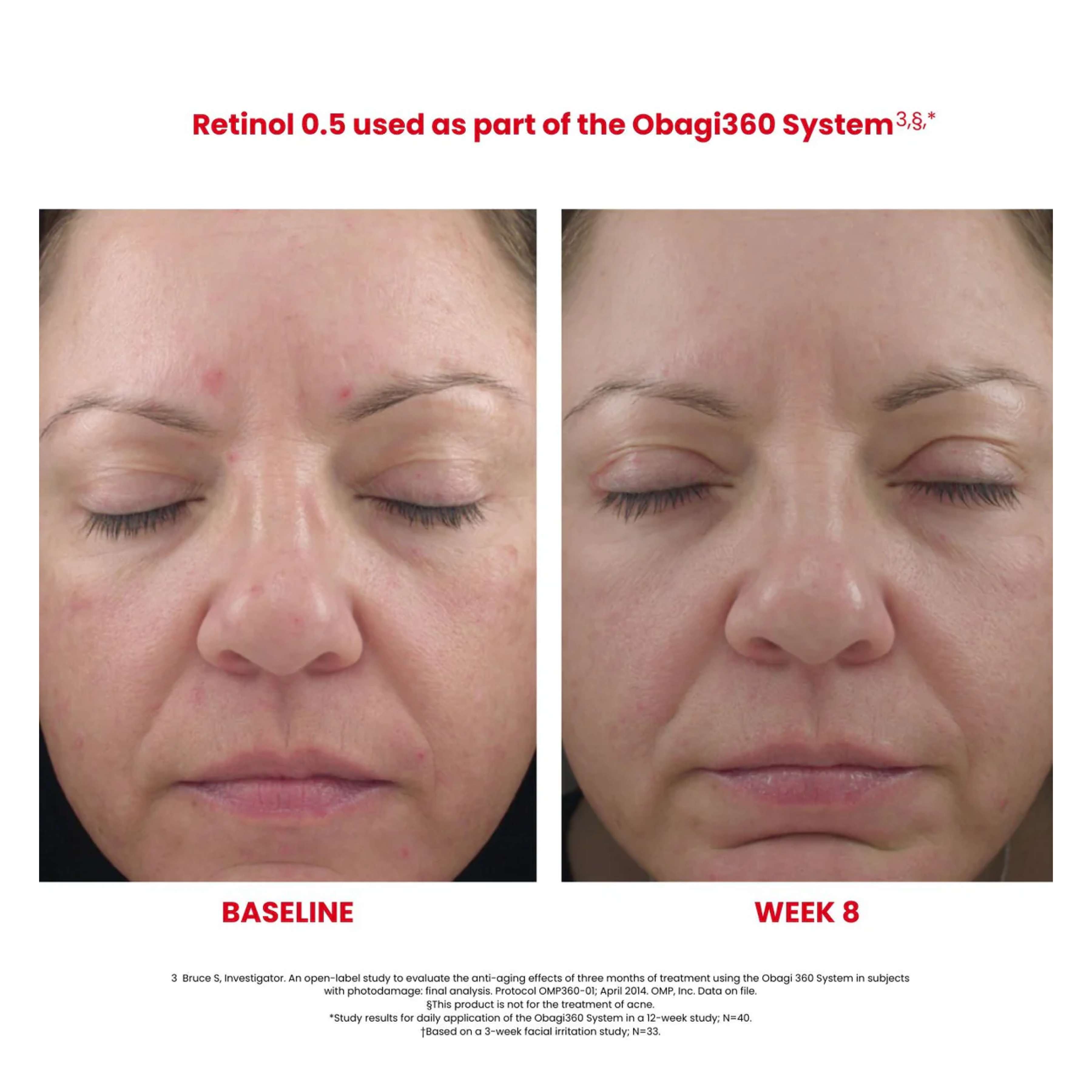 Obagi360® Smoothing Retinol 0.5