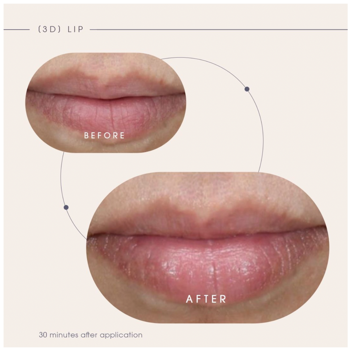 Teoxane [3D] Lip, Nourishing & Plumping Lip Care