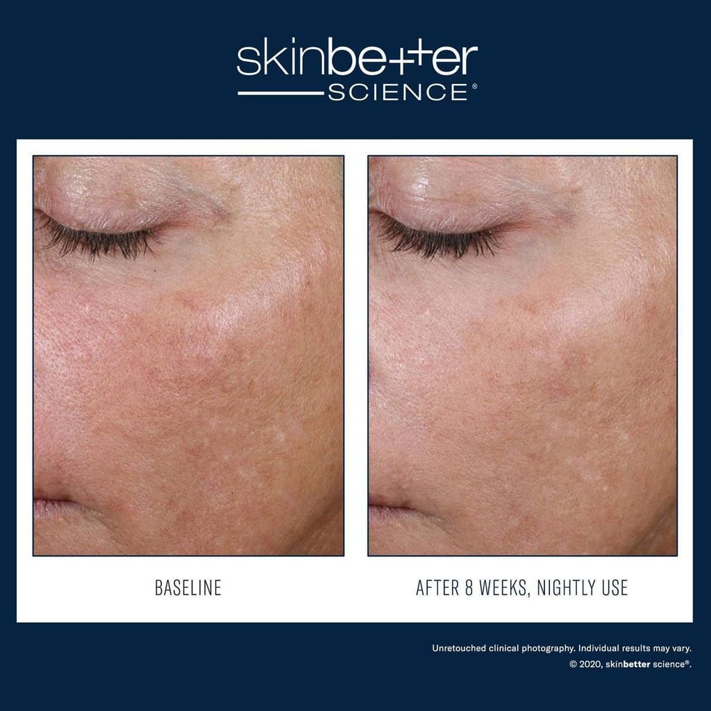 Skinbetter Science - AlphaRet Overnight Cream